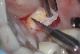 videoImg
