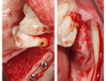 Live Surgery