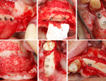 Live Surgery