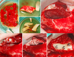 Live Surgery