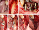 Live Surgery