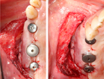 Live Surgery