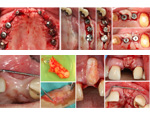 Live Surgery