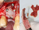 Live Surgery