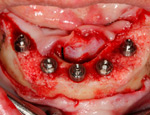 Live Surgery