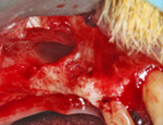 Live Surgery Live Surgery