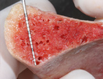 Live Surgery