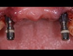 Video actualizado