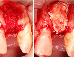 Live Surgery Live Surgery