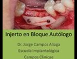 Caso actualizado