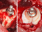 Live Surgery