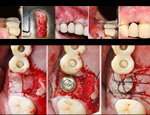 Live Surgery