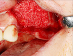 Live Surgery