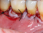 Live Surgery