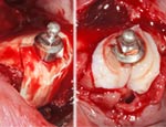 Live Surgery Live Surgery
